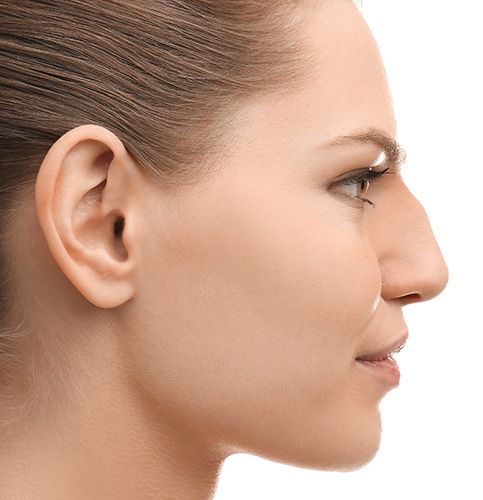 Vavi Clinics Izmir - Acik rinoplasti sonuclari