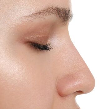 Vavi Clinics Izmir - Septorinoplasti